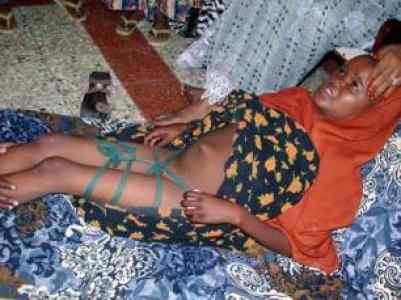 fgm_victim.jpeg