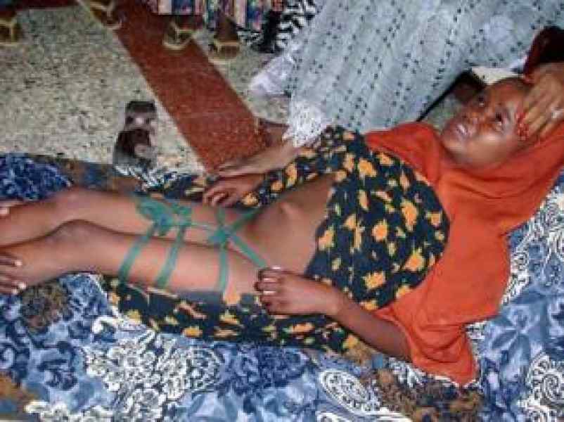 fgm_victim.jpeg